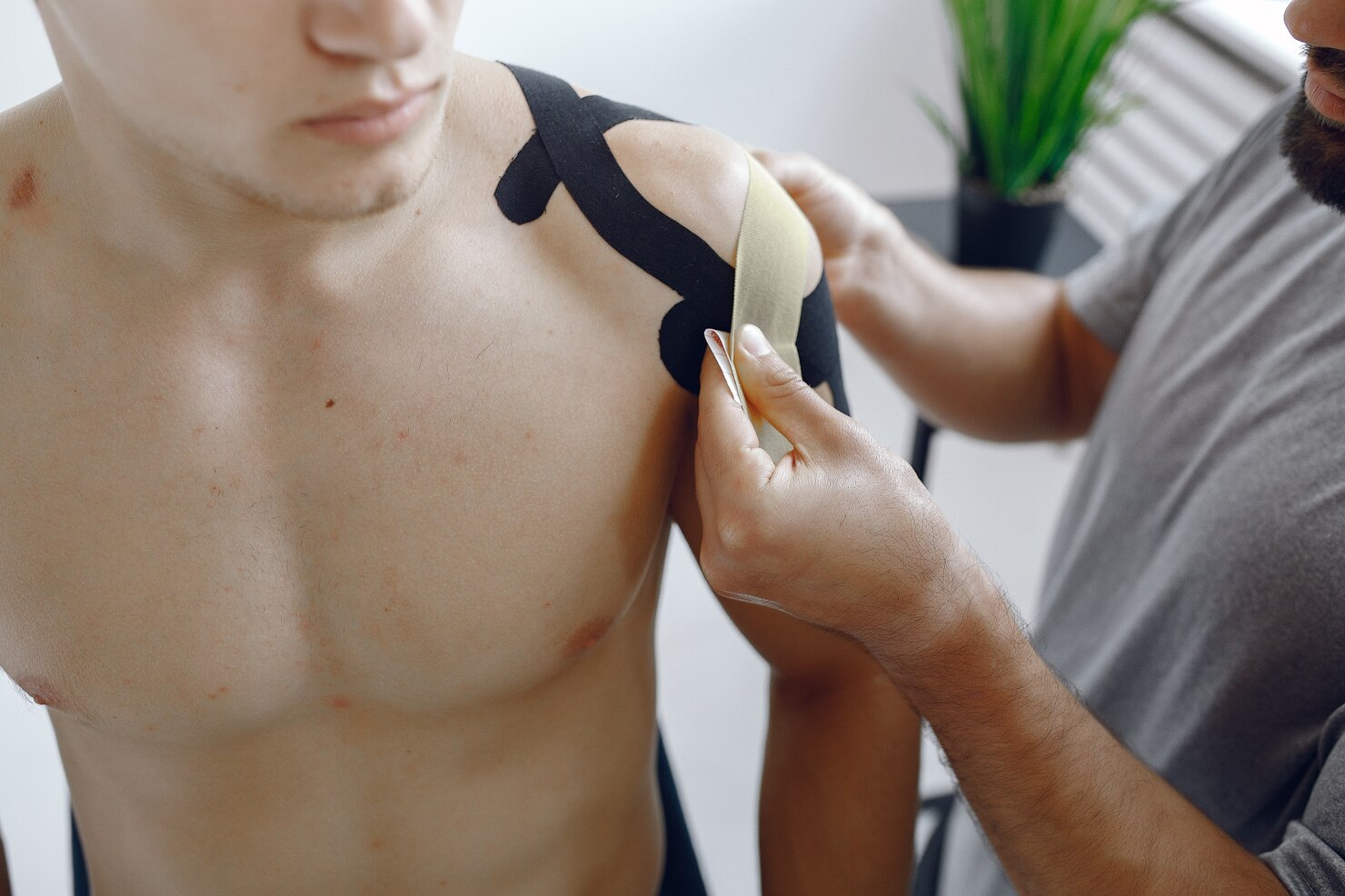 Frozen Shoulder (Adhesive Capsulitis)